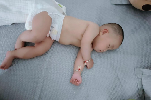 迁西宝宝头上长痱子 迁西宝宝头上长痱子